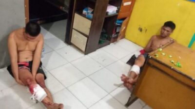 Suami Dalang Penyiraman Air Keras ke Istri Muda, Istri Tua Tanggung Biaya Sewa Pelaku