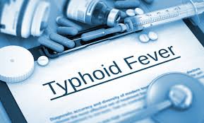 typhoid fever